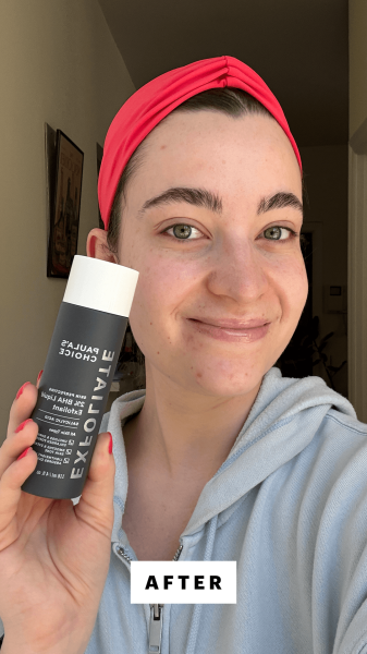 A selfie of Allure senior commerce editor Sarah Felbin after using the Paula's Choice Skin Perfecting 2 BHA Liquid Exfoliant